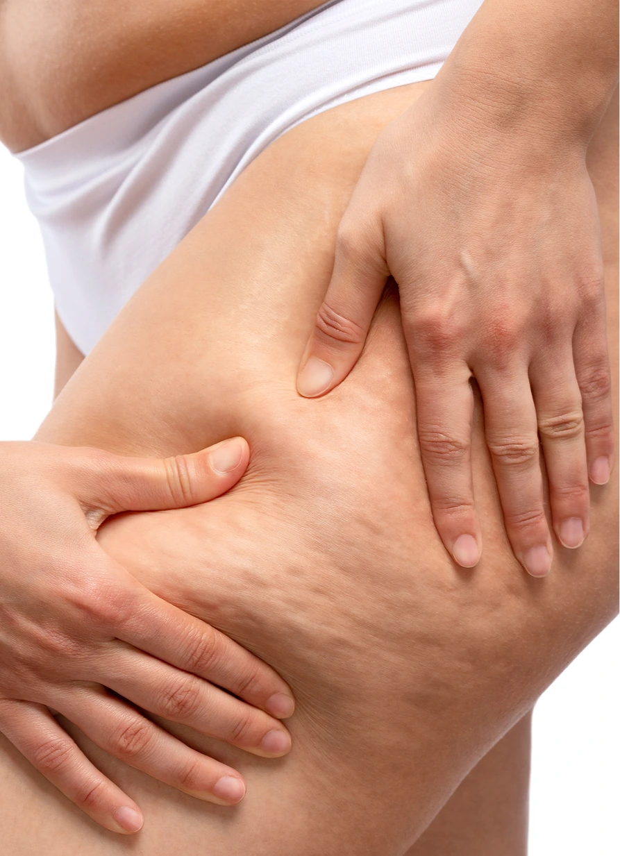 Recovery and Aftercare Cellulite Reduction McKinney, TX Banner